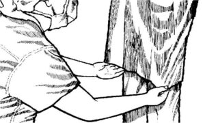 Figure 1-34. Straightening the gown.